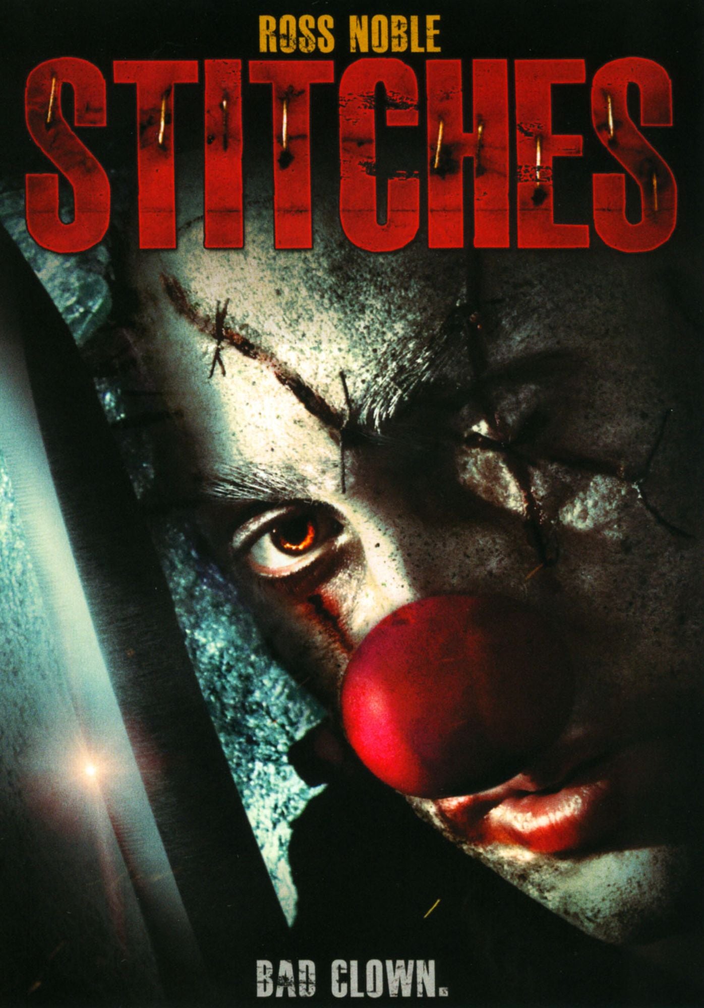 Stitches