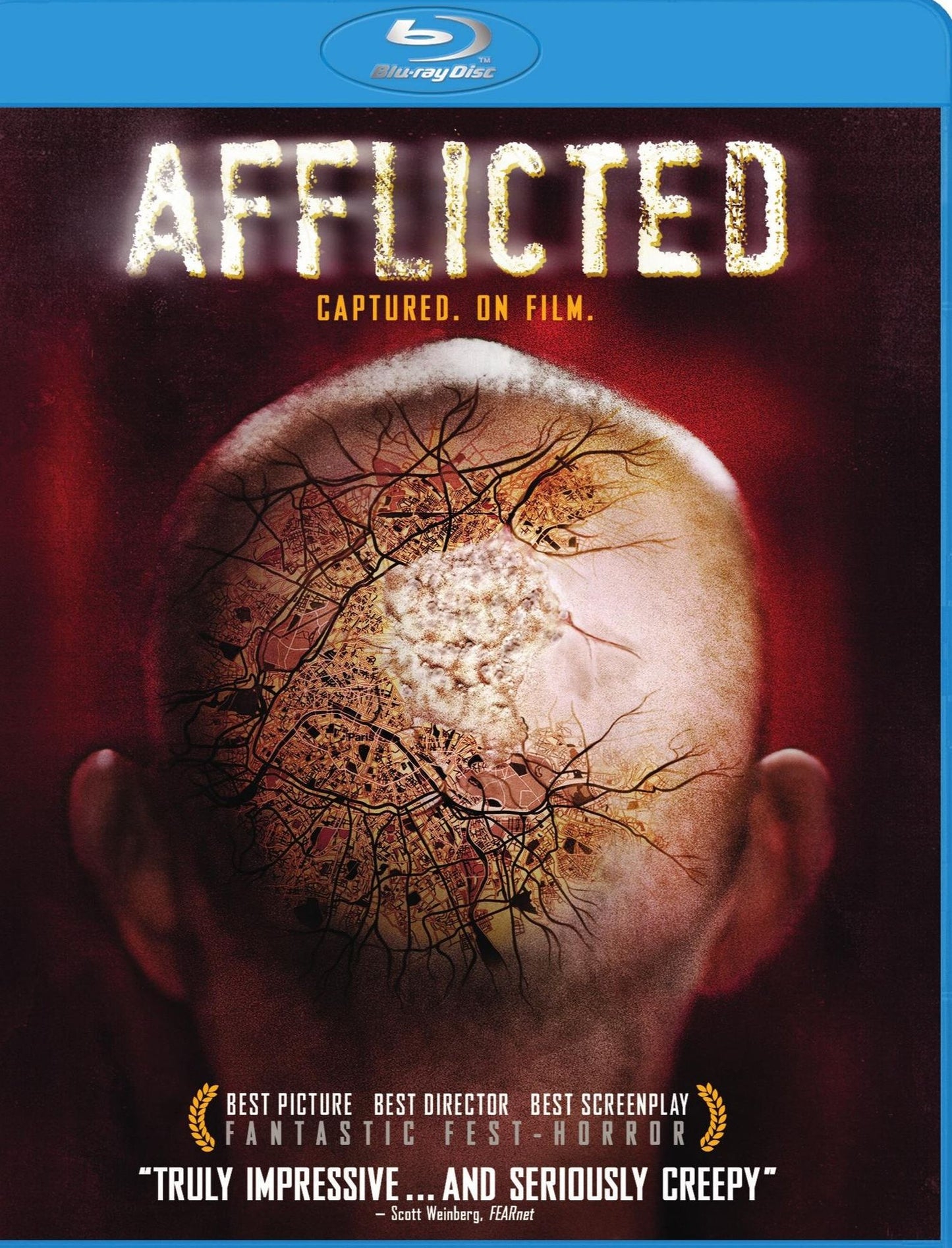 AFFLICTED / (BR UVDC)