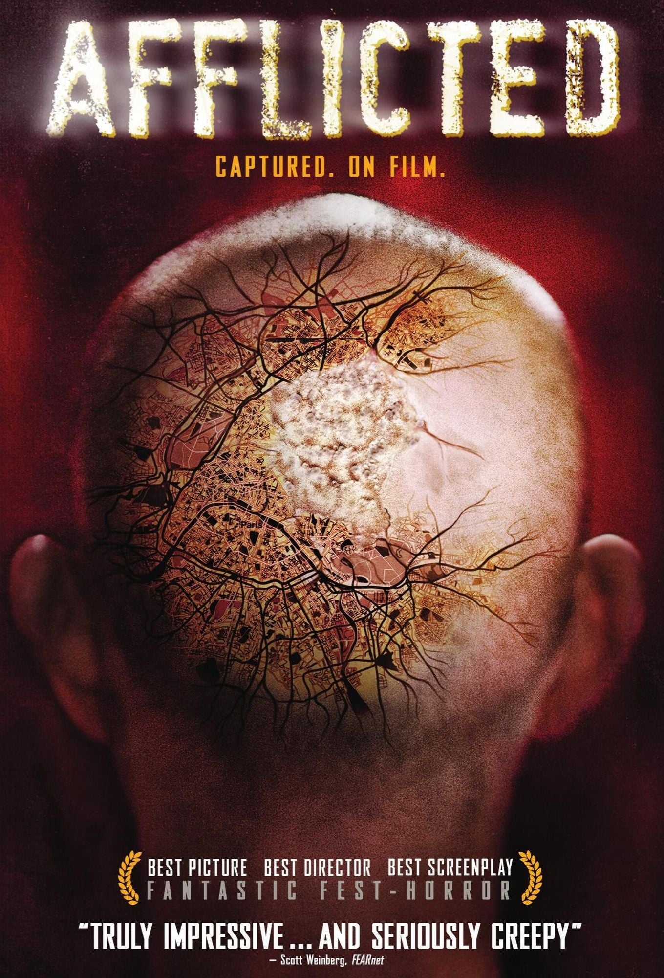 AFFLICTED / (UVDC)