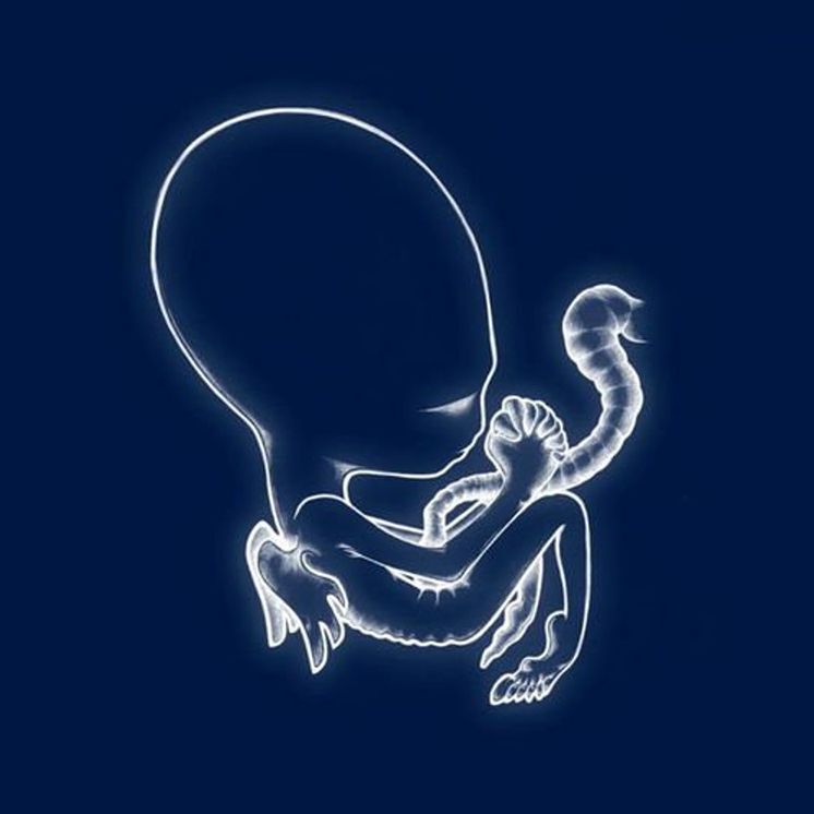 Agaetis Byrjun (Sigur Ros)