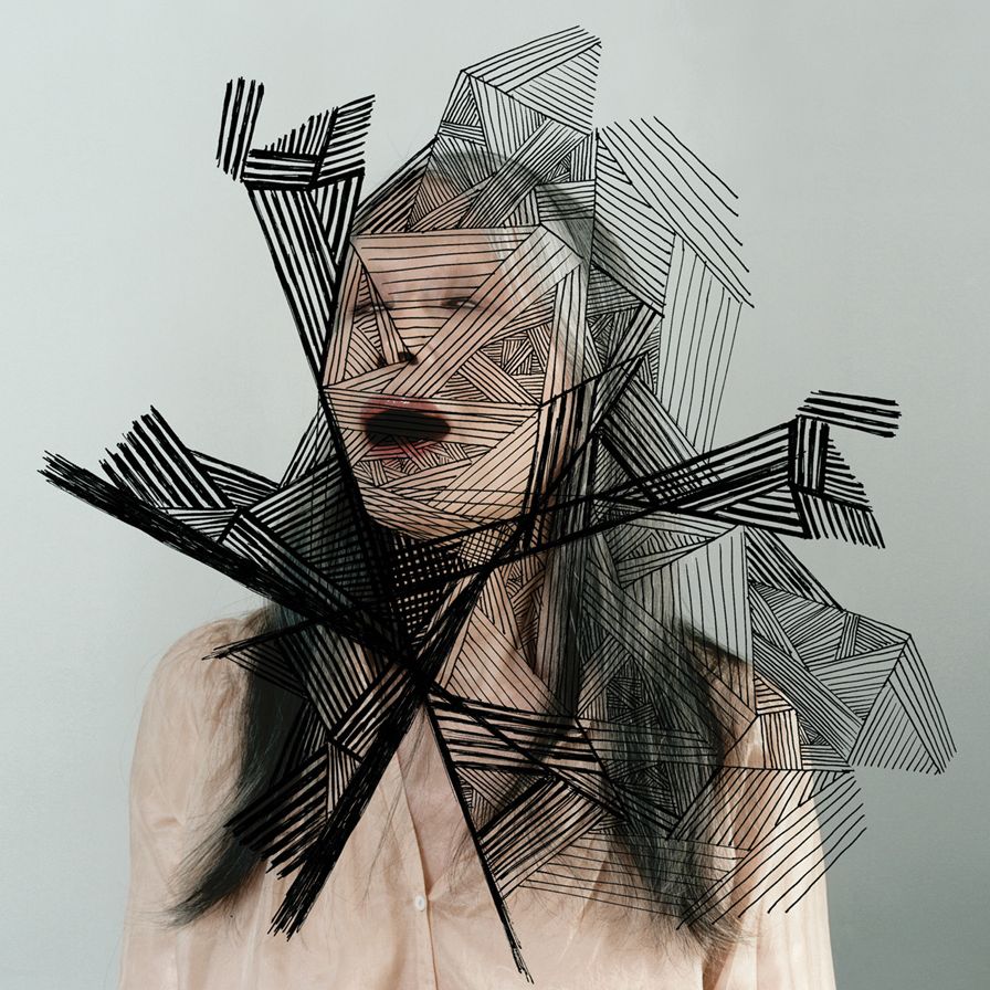 Epilepsy Is Dancing