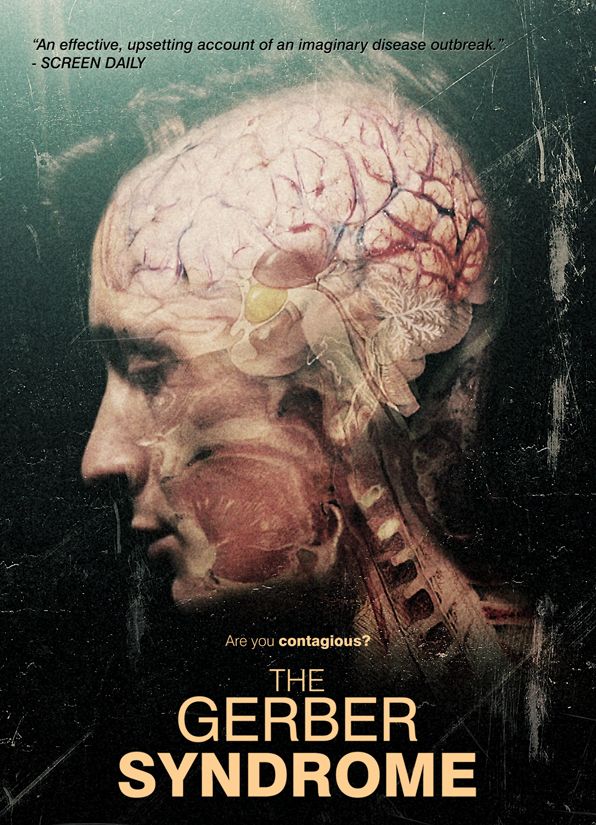 The Gerber Syndrome