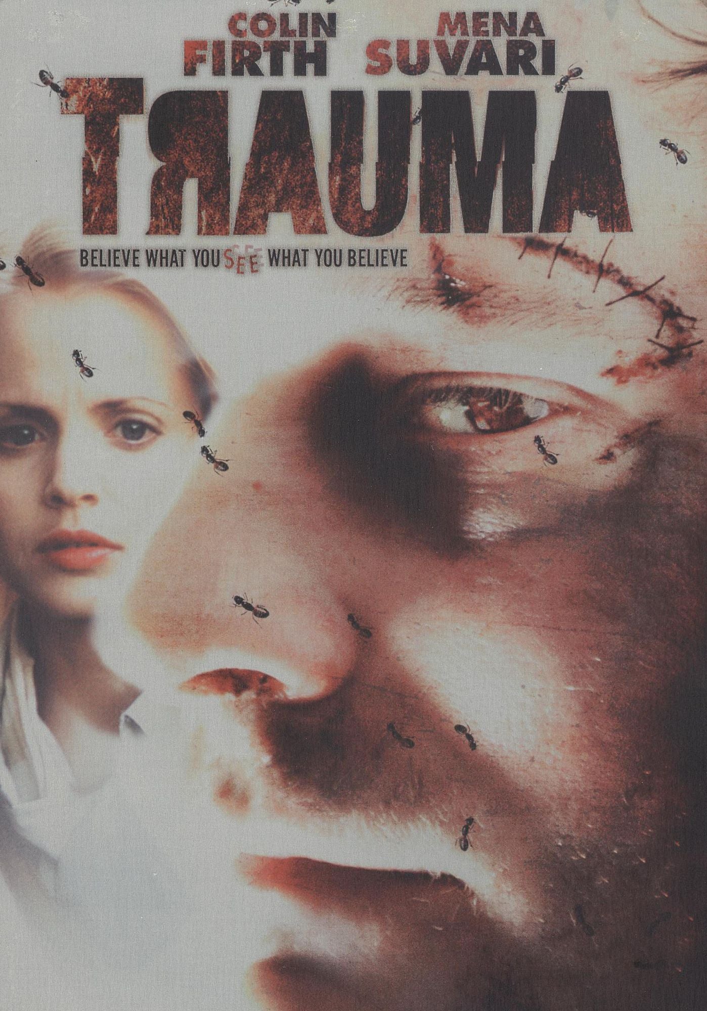 Trauma