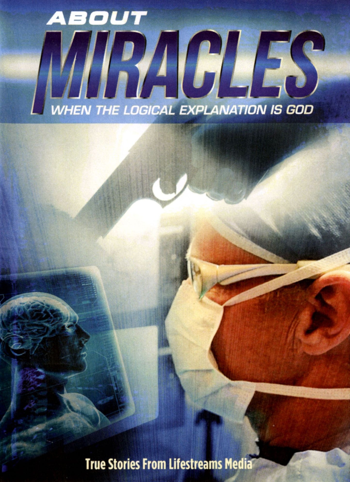 About Miracles