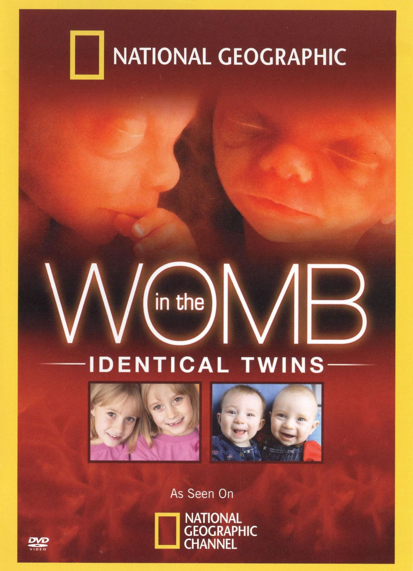 National Geographic: In the Womb - Identical Twins