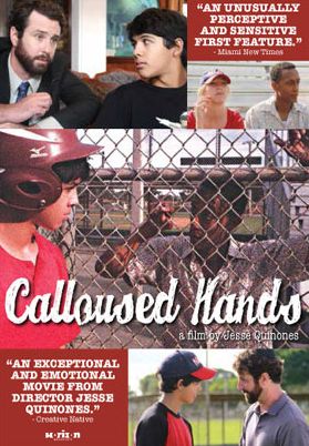 Calloused Hands