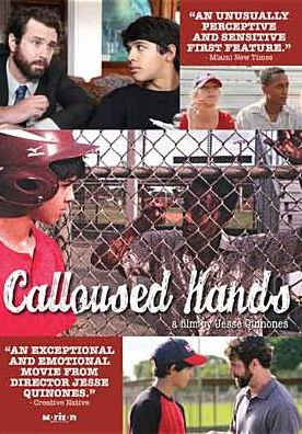 Calloused Hands
