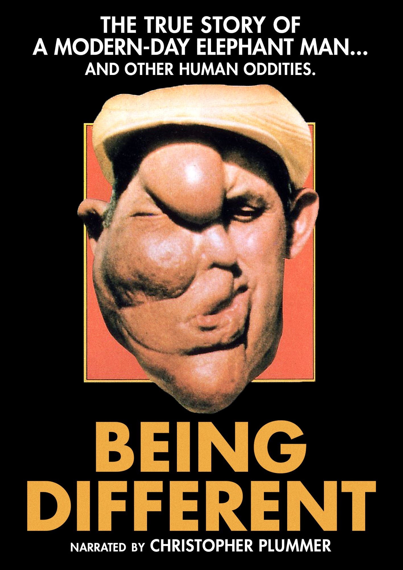 Being Different