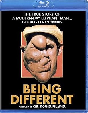 Being Different [Blu-ray]