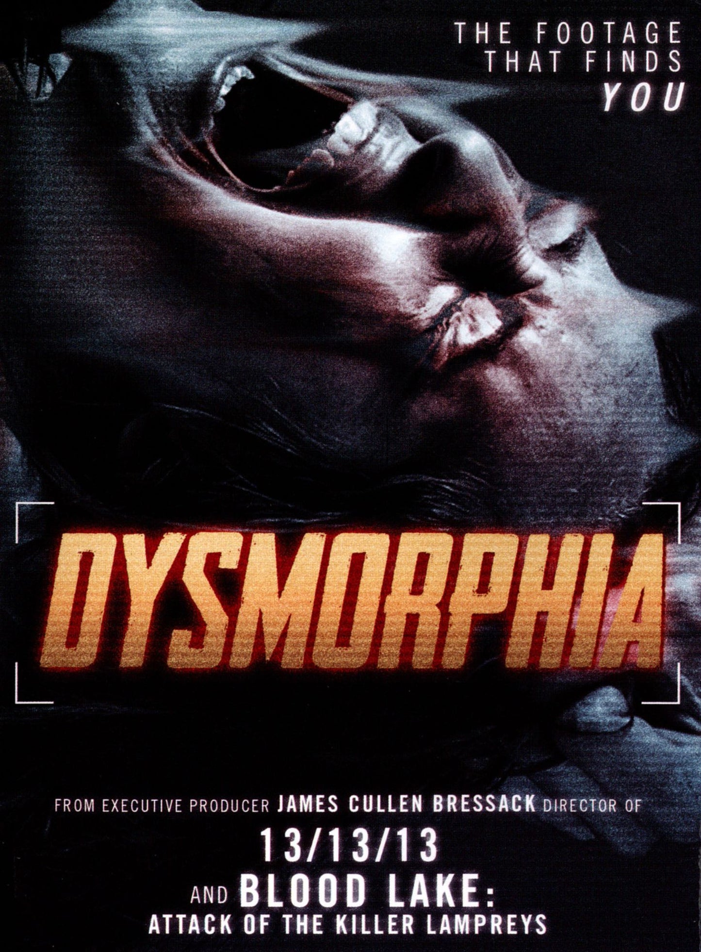 Dysmorphia