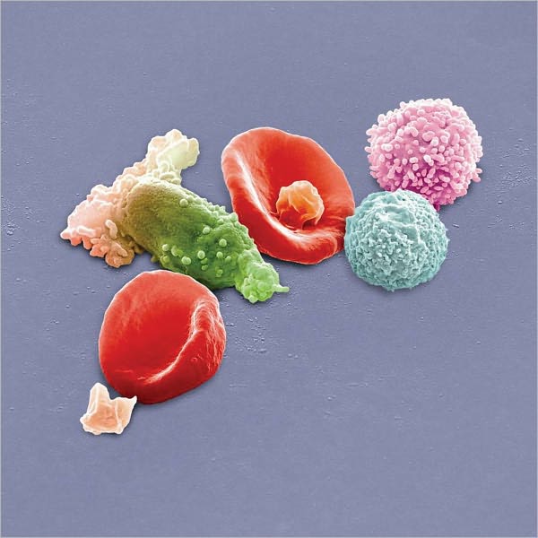 Peter Gabriel: New Blood - Live in London [Deluxe Edition] [4 Discs] [Blu-ray/DVD/CD]
