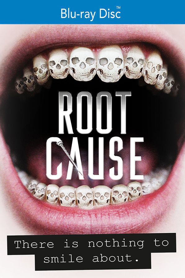 Root Cause