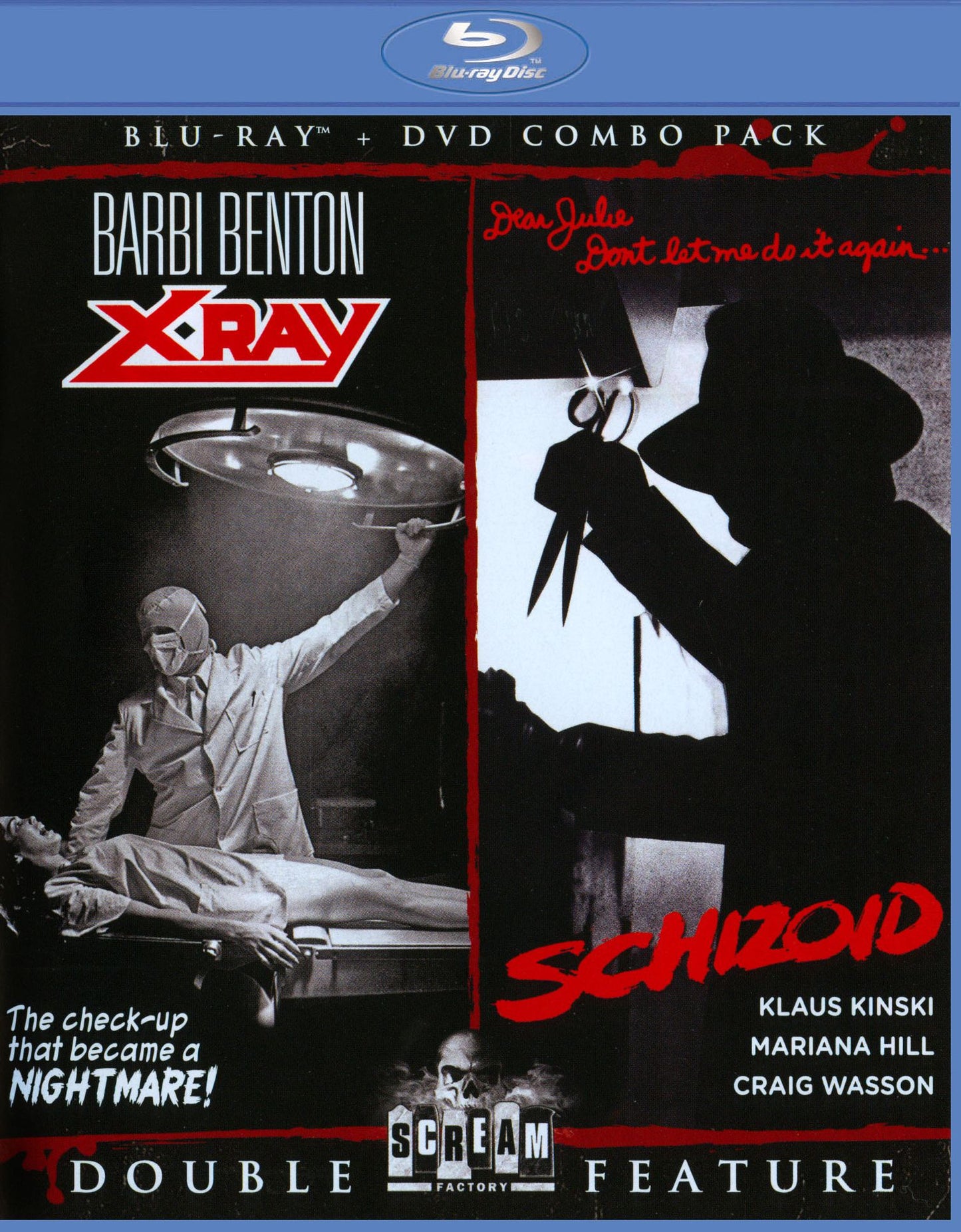 X-ray/schizoid