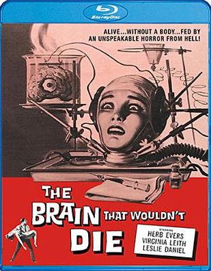 The Brain That Wouldn't Die