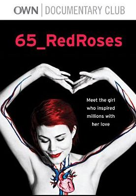65 Redroses