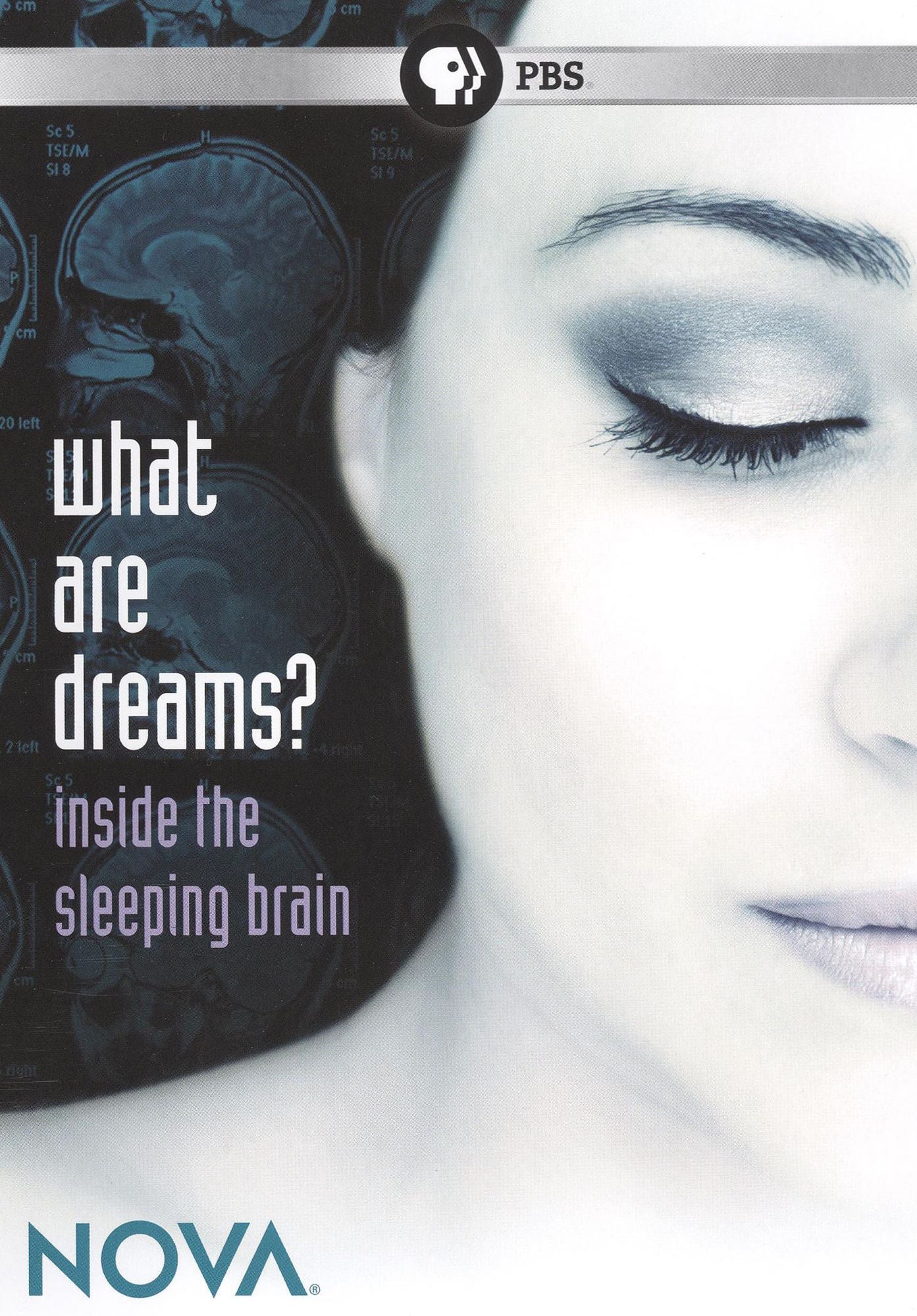 NOVA: What Are Dreams?