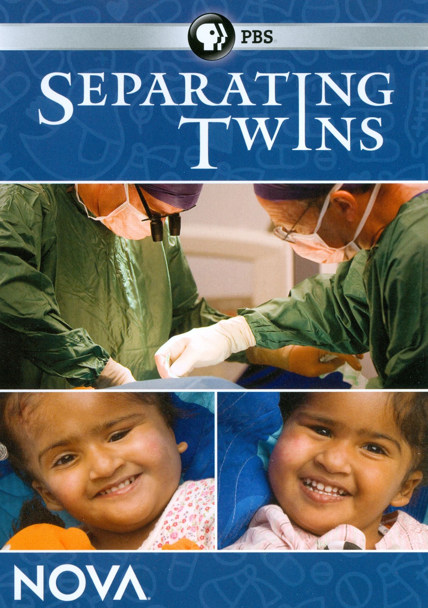 NOVA: Separating Twins