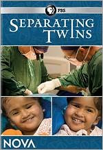 NOVA: Separating Twins