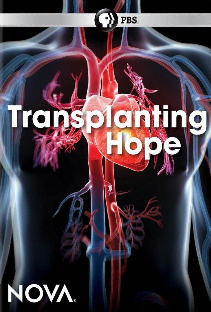 NOVA: Transplanting Hope