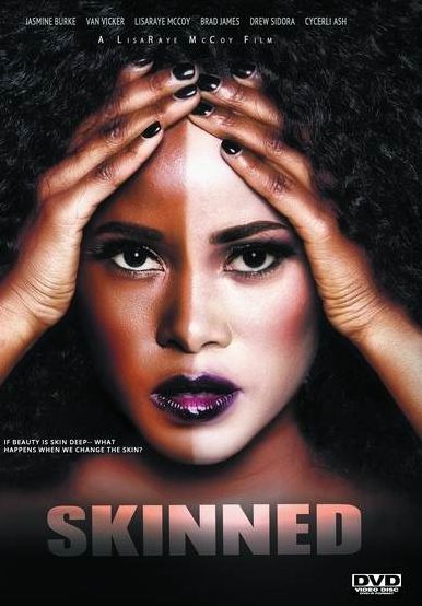Skinned