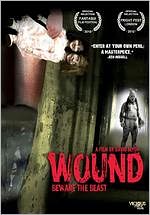 Wound