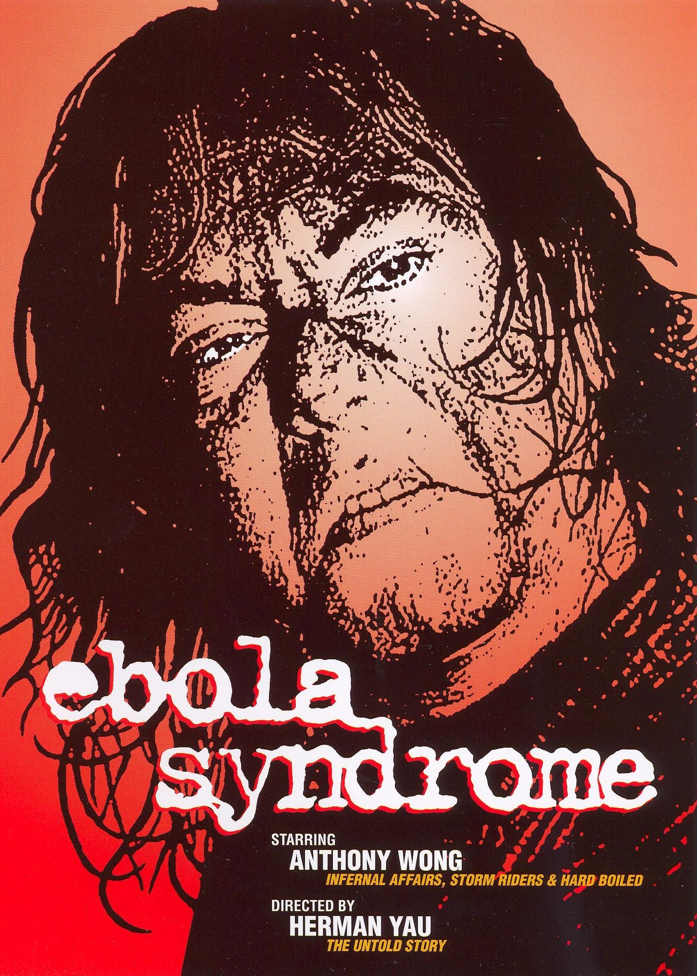 Ebola Syndrome