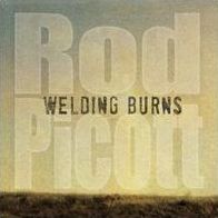 Welding Burns