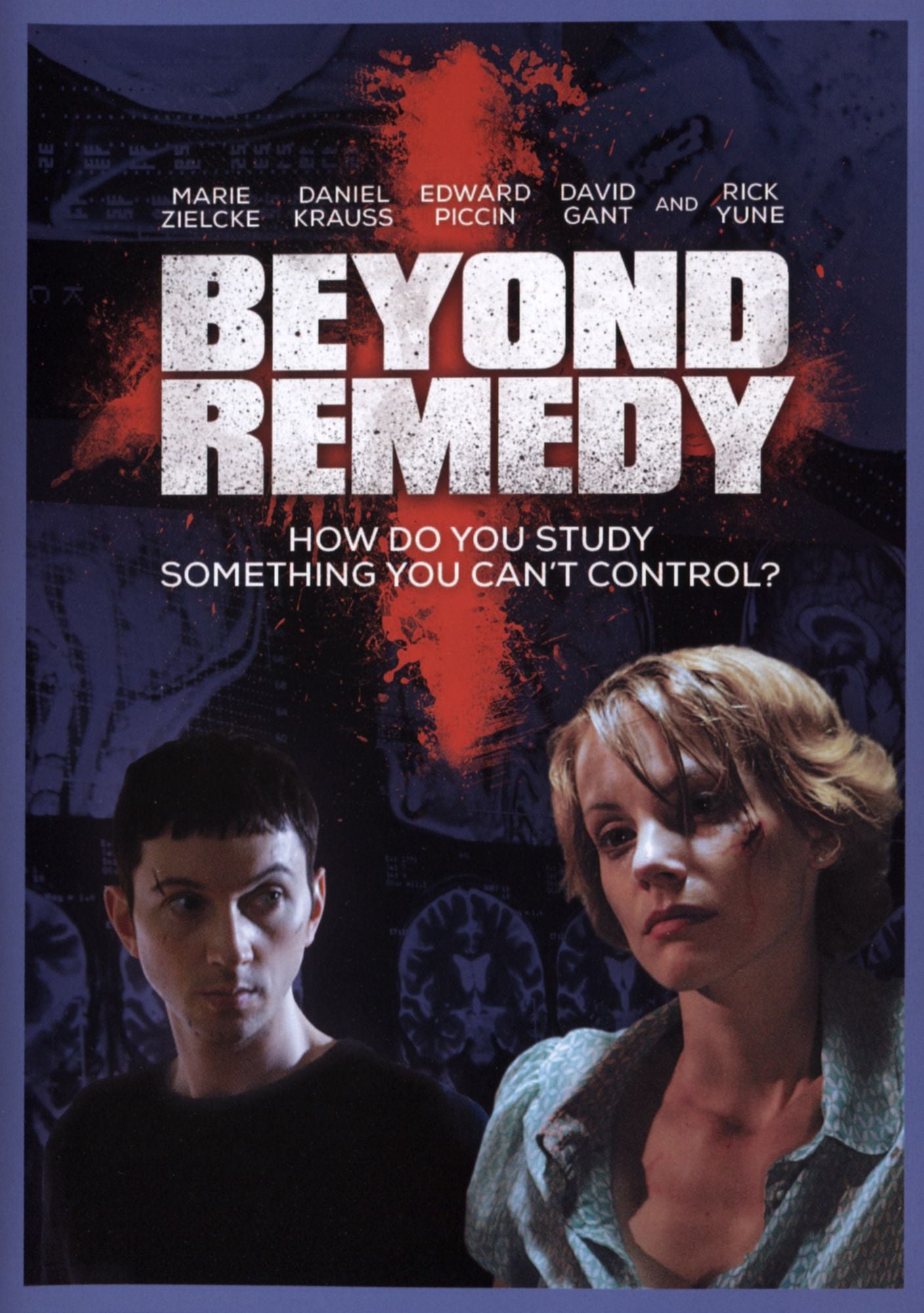 BEYOND REMEDY