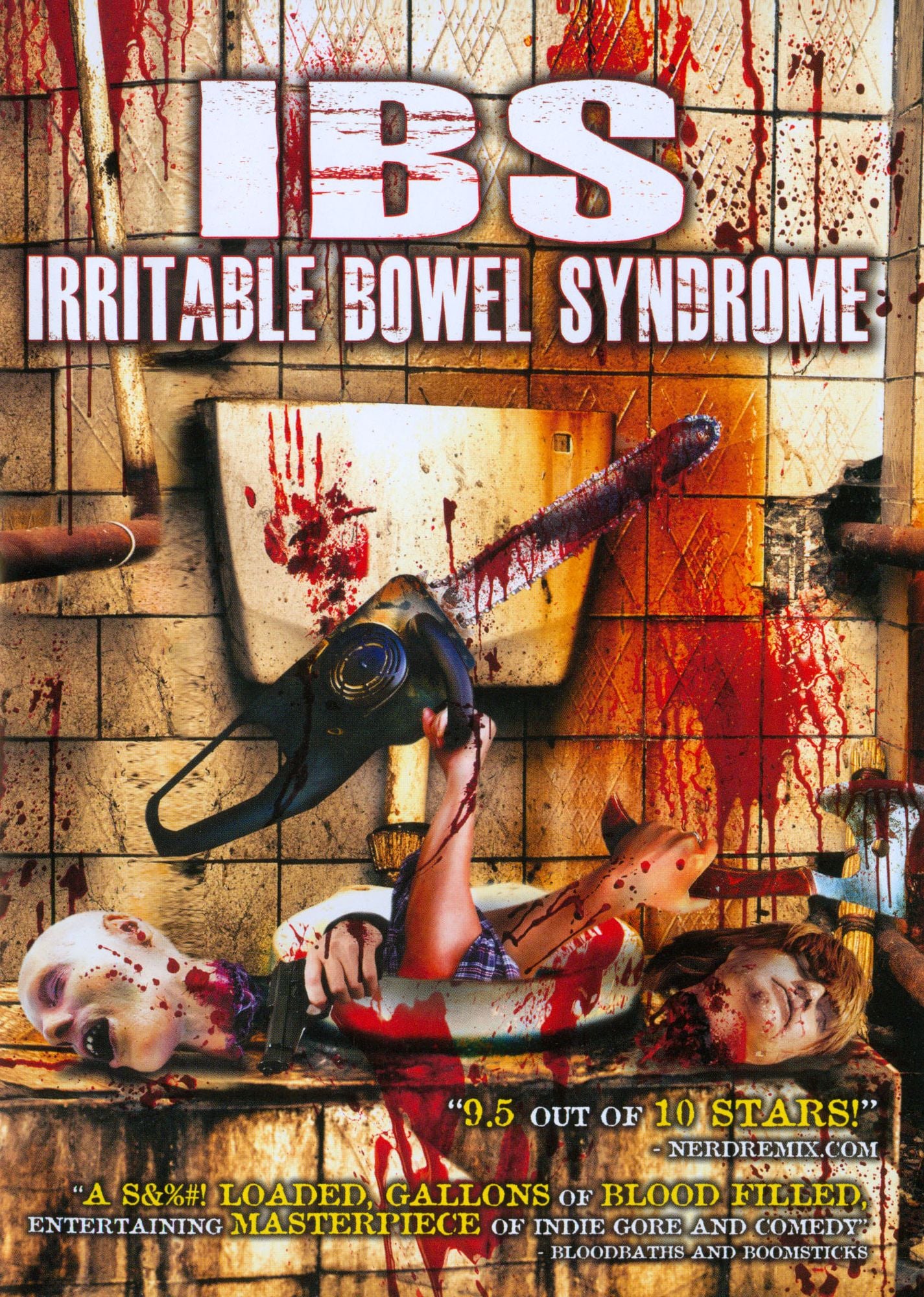 Ibs: Irritable Bowel Syndrome