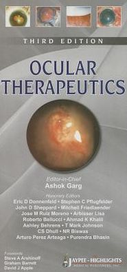 Ocular Therapeutics