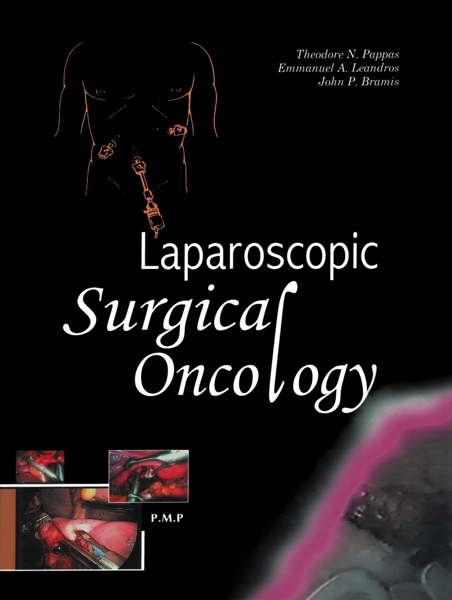 Laparoscopic Surgical Oncology