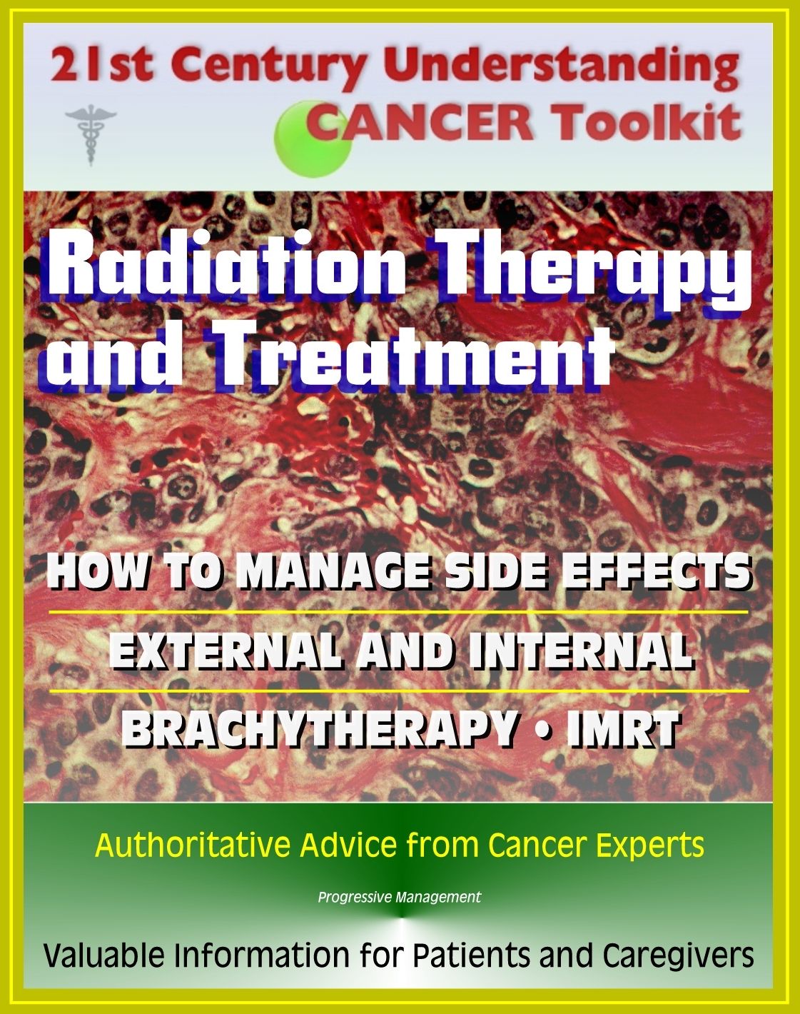 21st Century Understanding Cancer Toolkit: Radiation Therapy and Treatment, Side Effect Management, External, Internal, IMRT, Brachytherapy - Information for Patients, Families, Caregivers