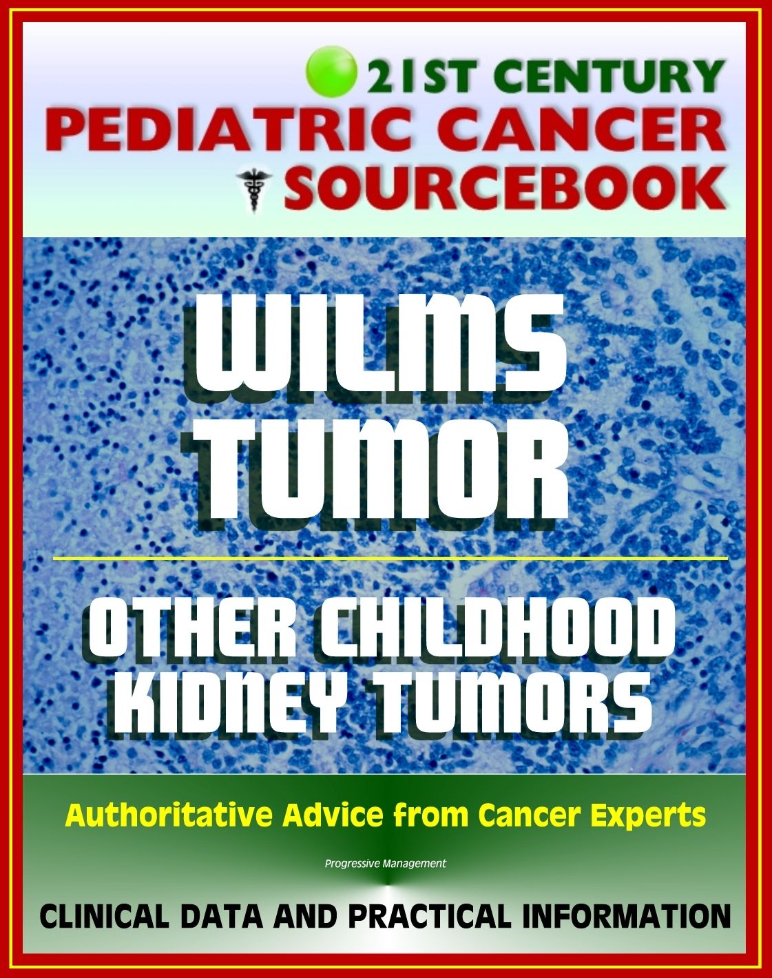 21st Century Pediatric Cancer Sourcebook: Wilms Tumor (WT) and Other Childhood Kidney Tumors - Clinical Data for Patients, Families, and Physicians