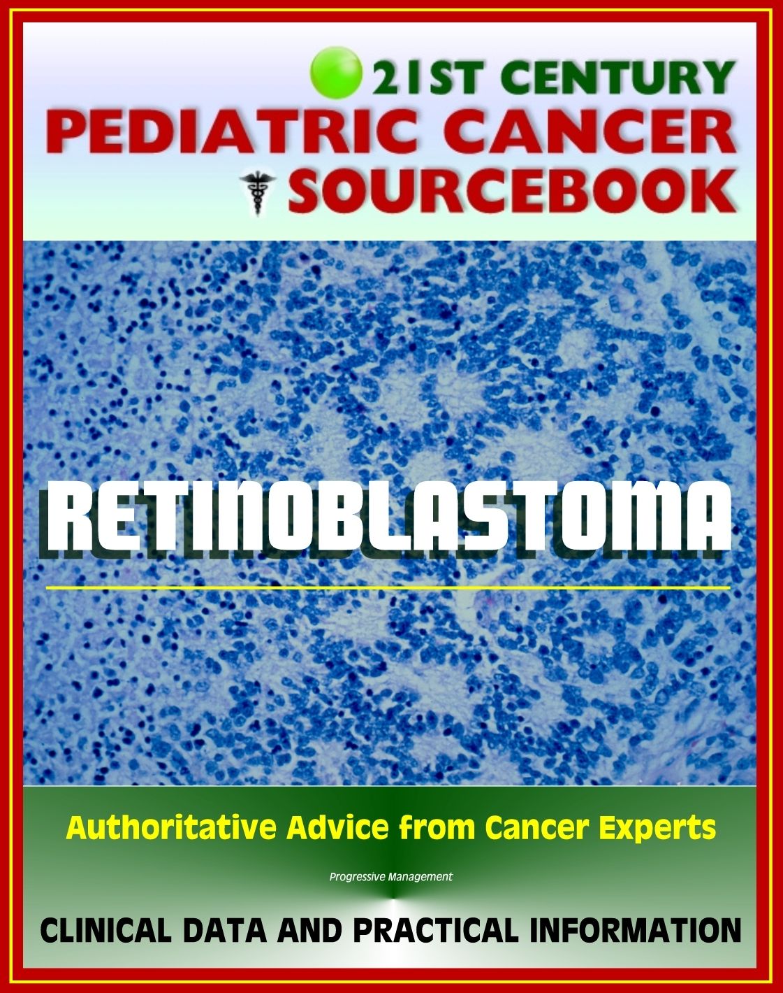 21st Century Pediatric Cancer Sourcebook: Retinoblastoma (Eye Tumor of the Retina) - Clinical Data for Patients, Families, and Physicians