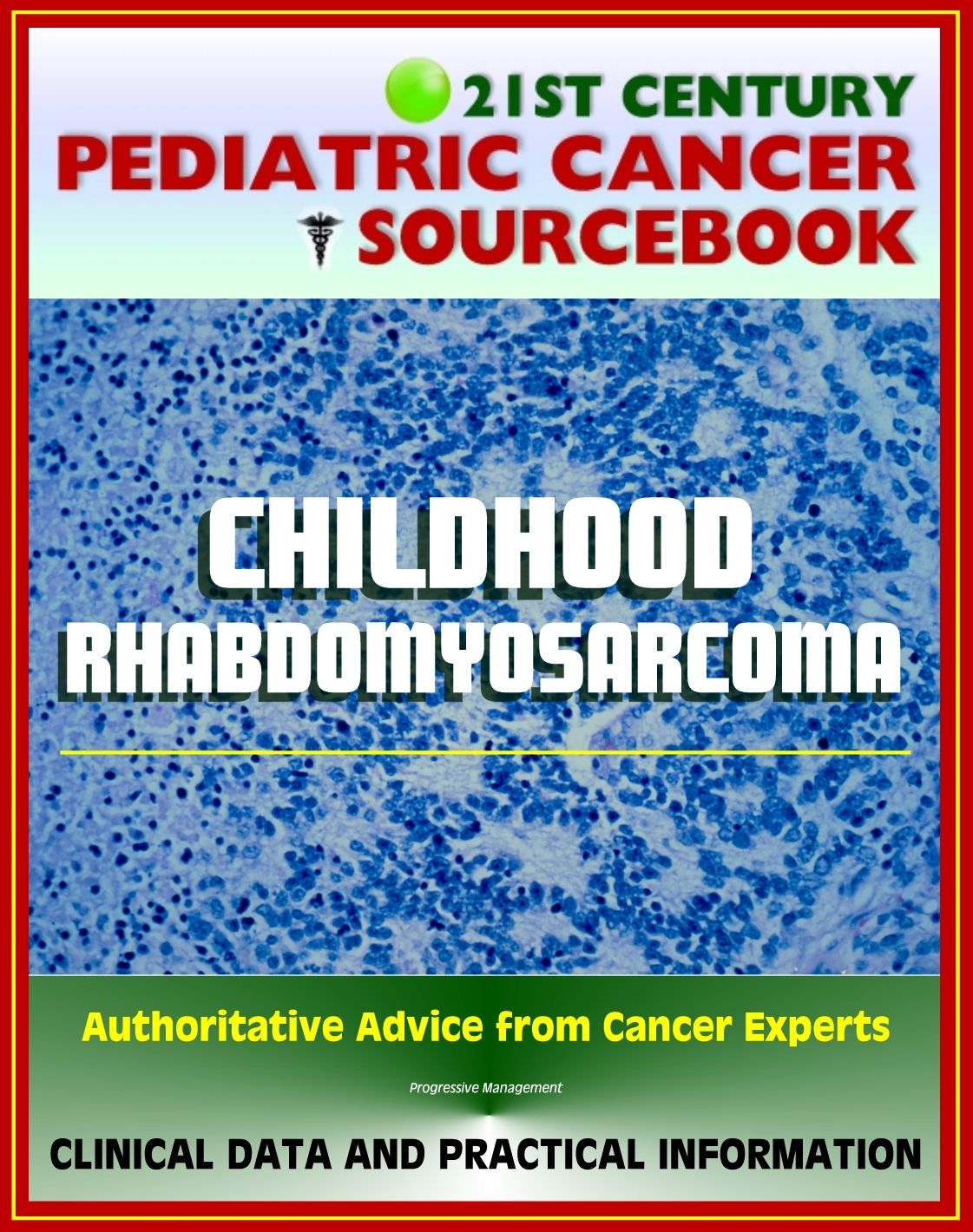 21st Century Pediatric Cancer Sourcebook: Childhood Rhabdomyosarcoma (Embryonal, Alveolar, Anaplastic) - Clinical Data for Patients, Families, and Physicians