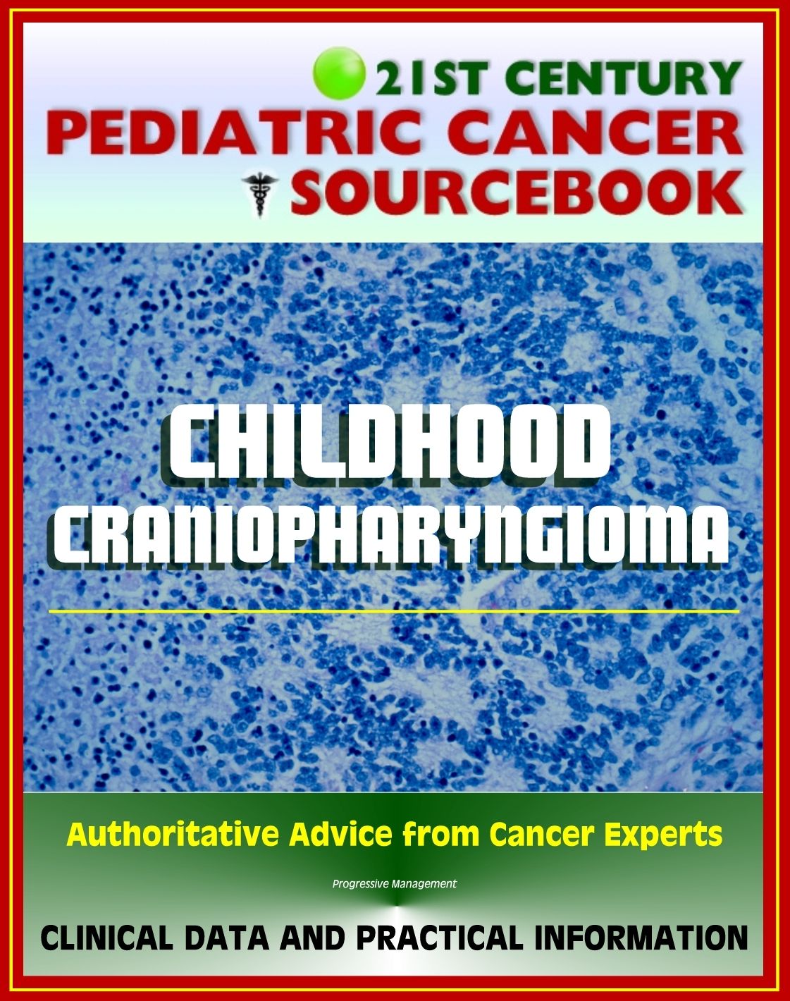 21st Century Pediatric Cancer Sourcebook: Childhood Craniopharyngiomas - Clinical Data and Practical Information for Patients, Families, and Physicians
