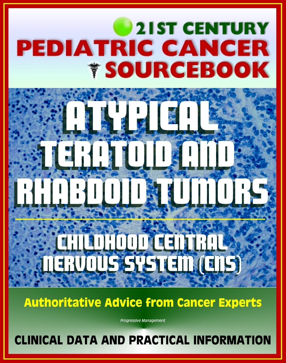 21st Century Pediatric Cancer Sourcebook: Atypical Teratoid and Rhabdoid Tumors (AT/RT) of the Central Nervous System - Clinical Data, Practical Information for Patients, Physicians