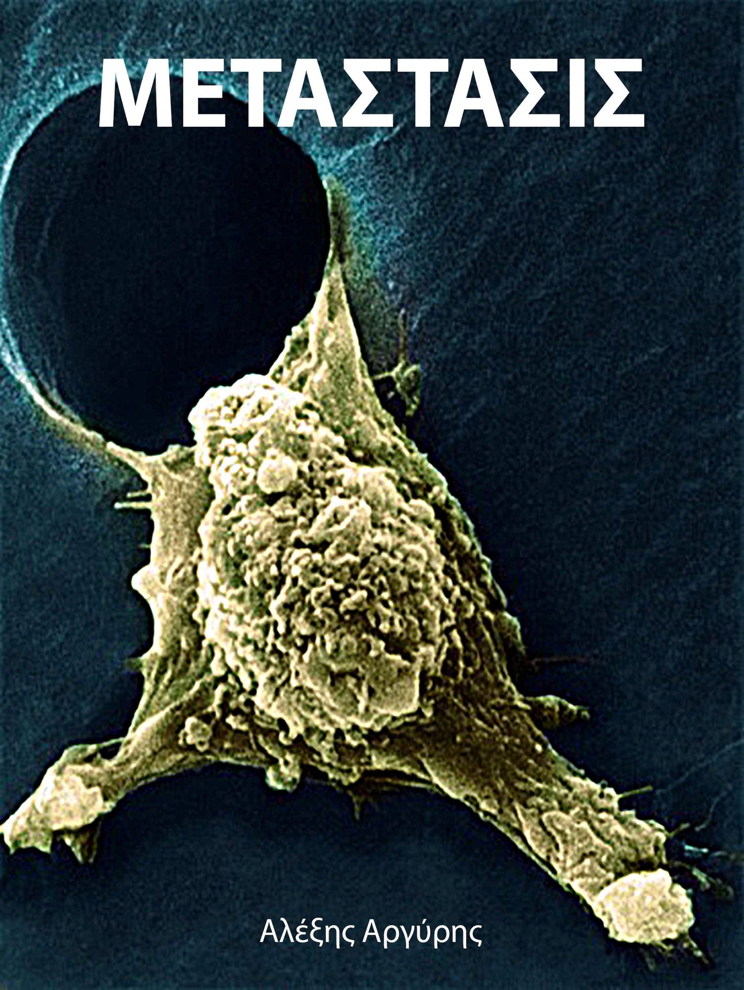 Metastasis