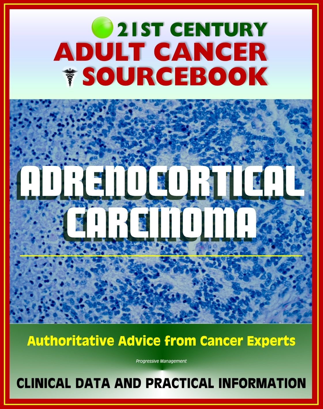 21st Century Adult Cancer Sourcebook: Adrenocortical Carcinoma, Cancer of the Adrenal Cortex - Clinical Data for Patients, Families, and Physicians