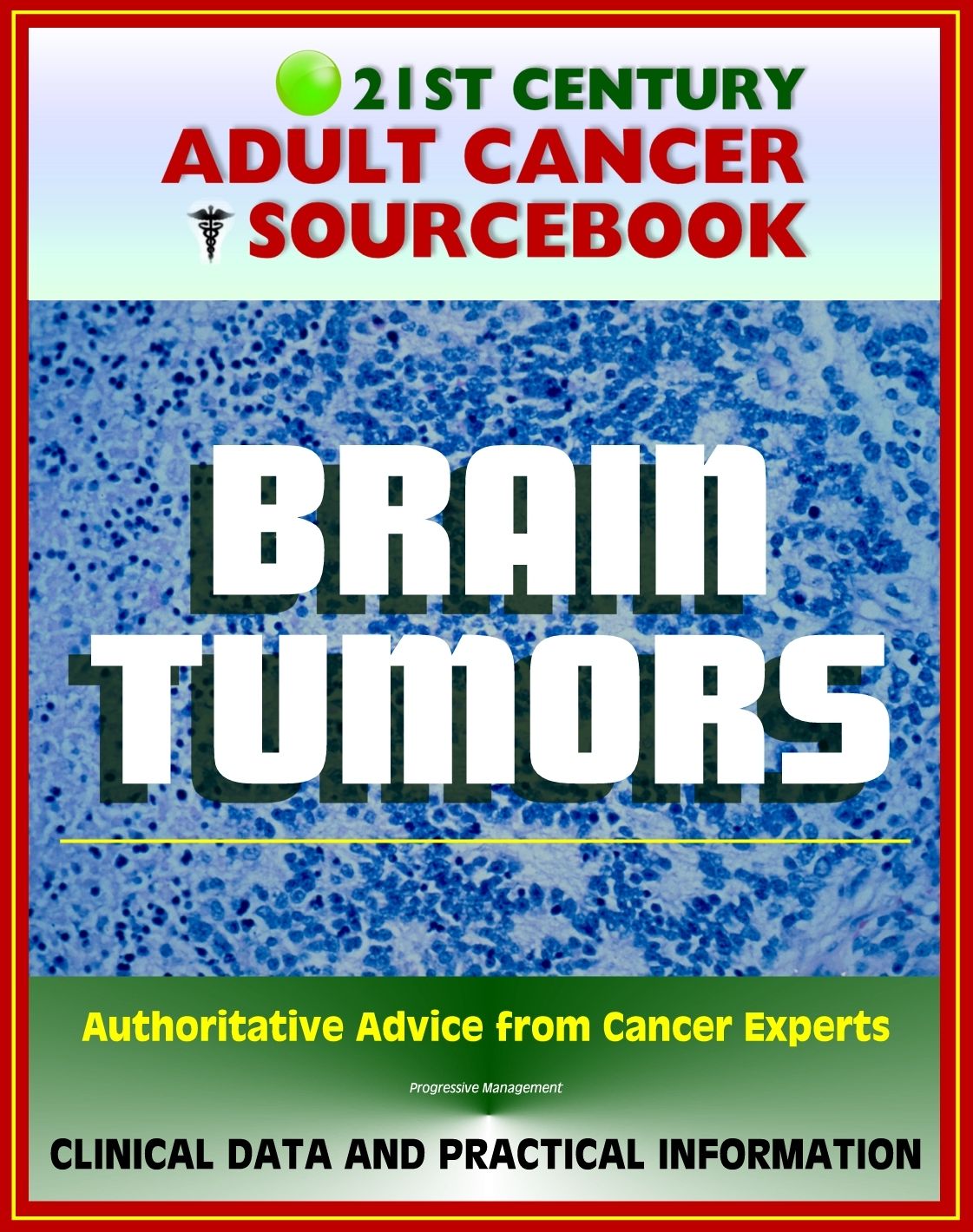 21st Century Adult Cancer Sourcebook: Adult Brain Tumors - Primary Malignant Tumors, Glioma, Astrocytoma, Meningioma, Oligodendroglioma, Ependymoma, Glioblastoma