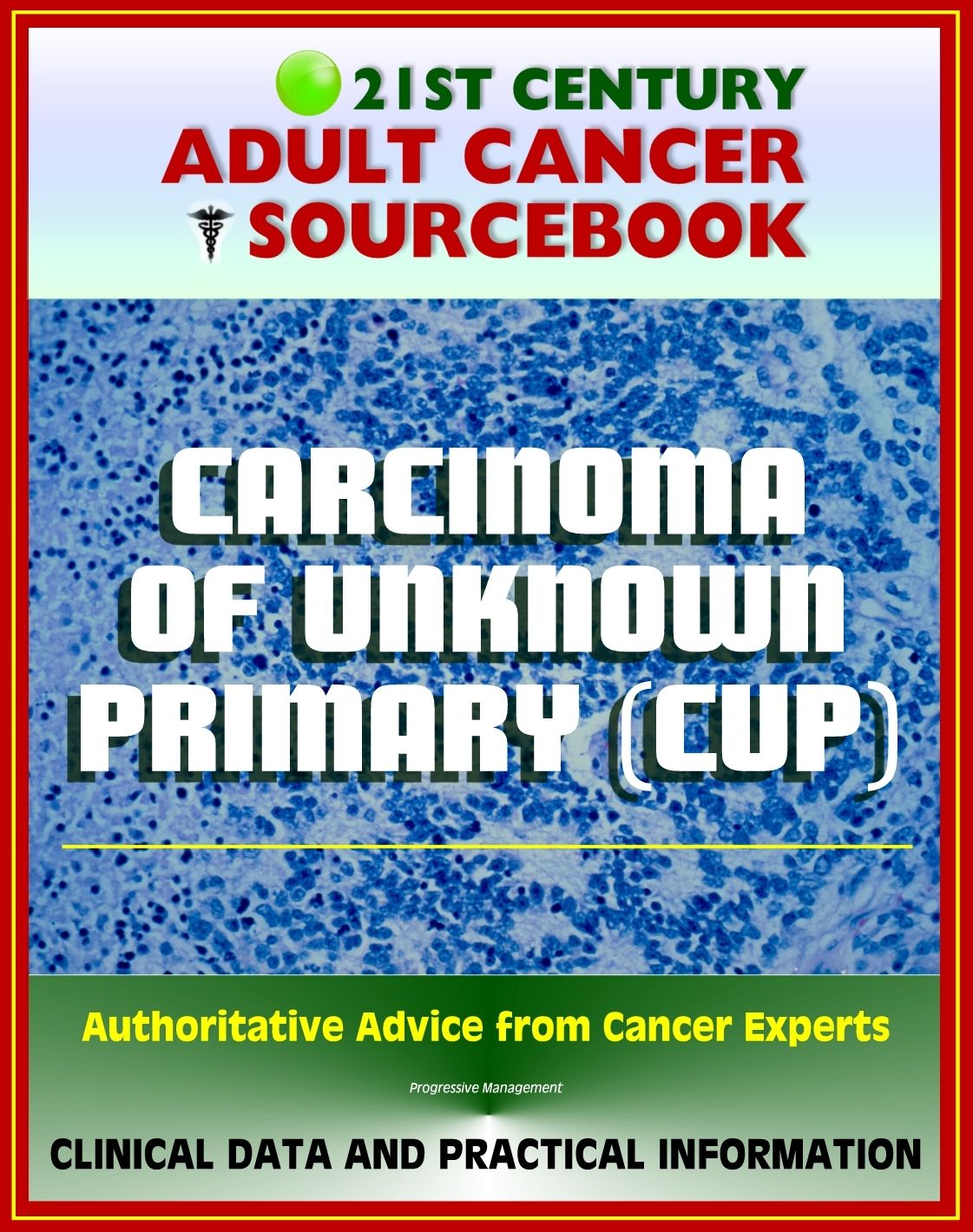 21st Century Adult Cancer Sourcebook: Carcinoma of Unknown Primary (CUP), Occult Primary Malignancy - Clinical Data for Patients, Families, and Physicians