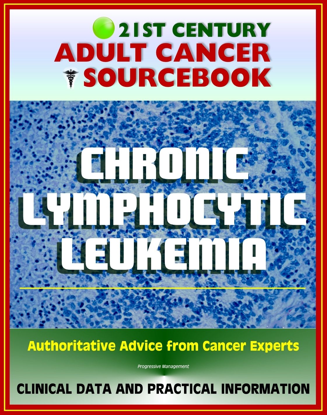 21st Century Adult Cancer Sourcebook: Chronic Lymphocytic Leukemia (CLL) - Clinical Data for Patients, Families, and Physicians