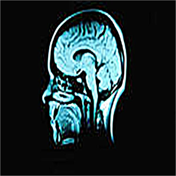 Within the Mind of the Insane