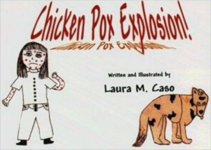CHICKEN POX EXPLOSION