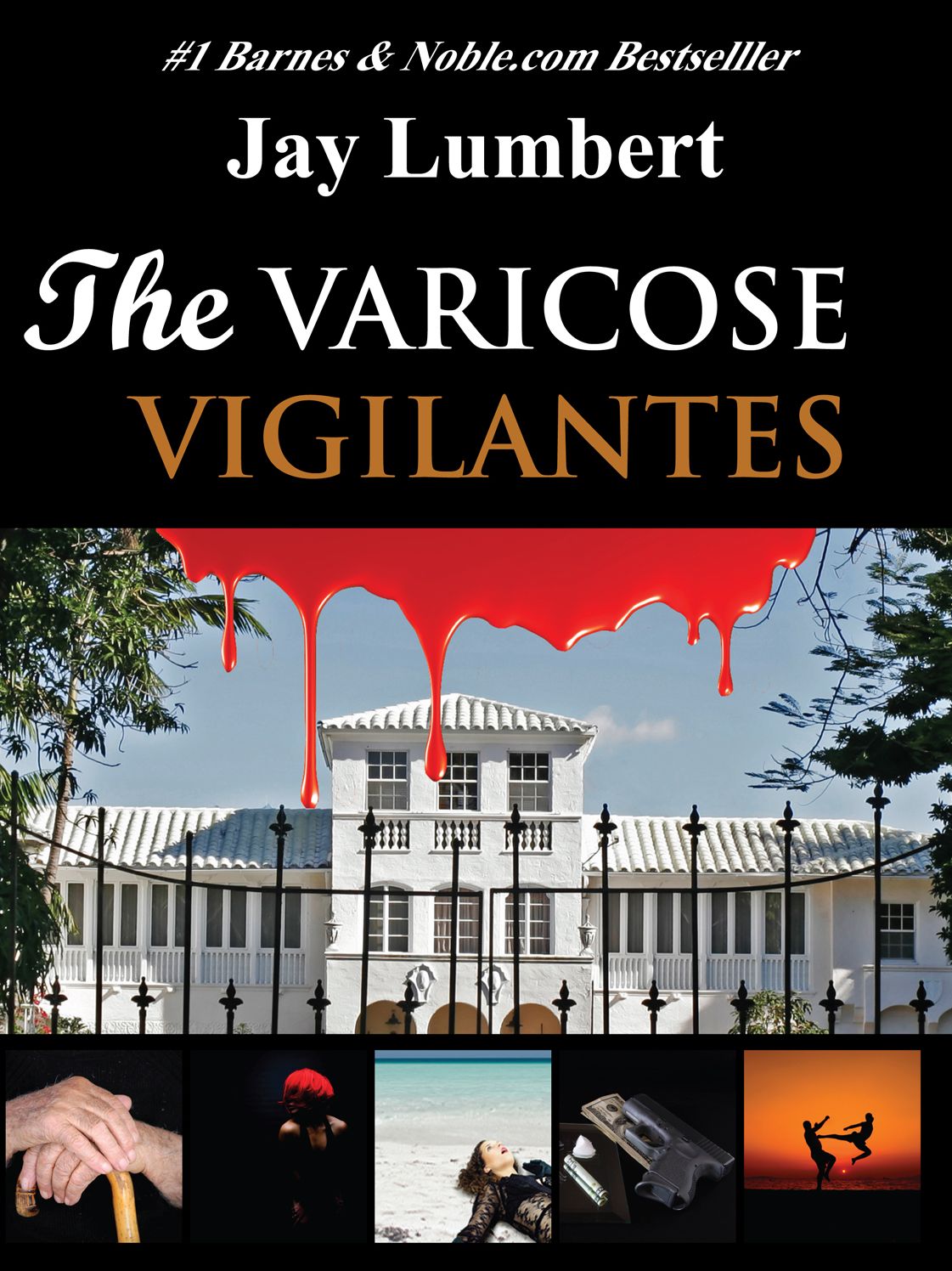 The Varicose Vigilantes