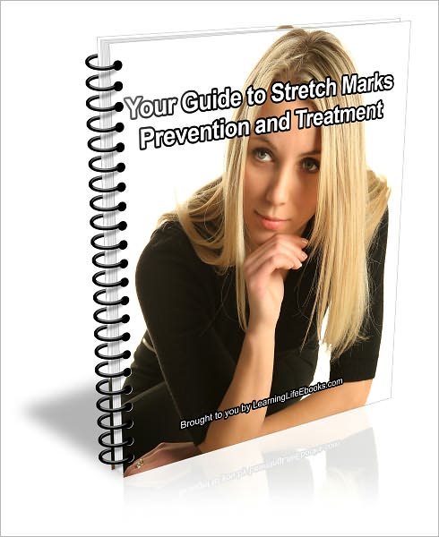 Your Guide to Stretch Marks: Prevention and Treatment