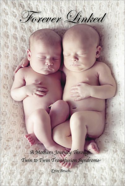 Forever Linked: A Mother's Journey Through Twin to Twin Transfusion Syndrome