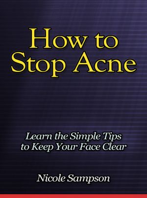 How to Stop Acne - Learn the Simple Tips to Keep Your Face Clear