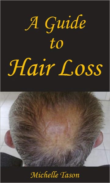 A Guide To Hair Loss