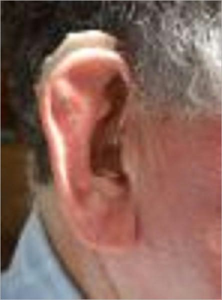 Hearing Aids: Are They for You ?